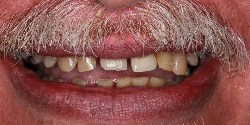 Before_After_Before_1