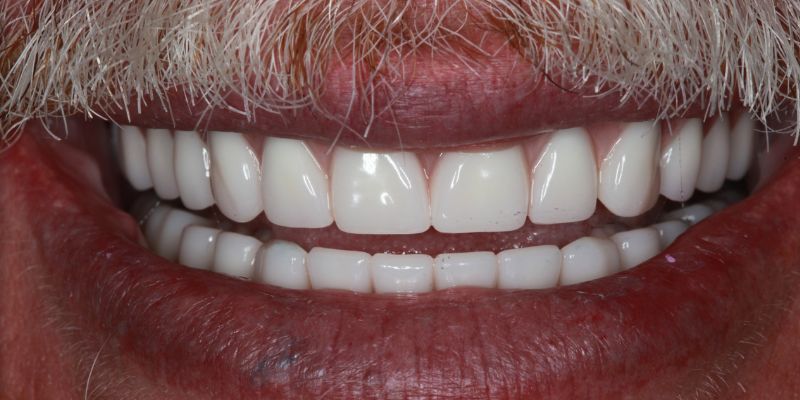 Before_After_Slide_1