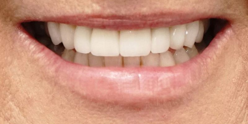 Before_After_Slide_4_After3