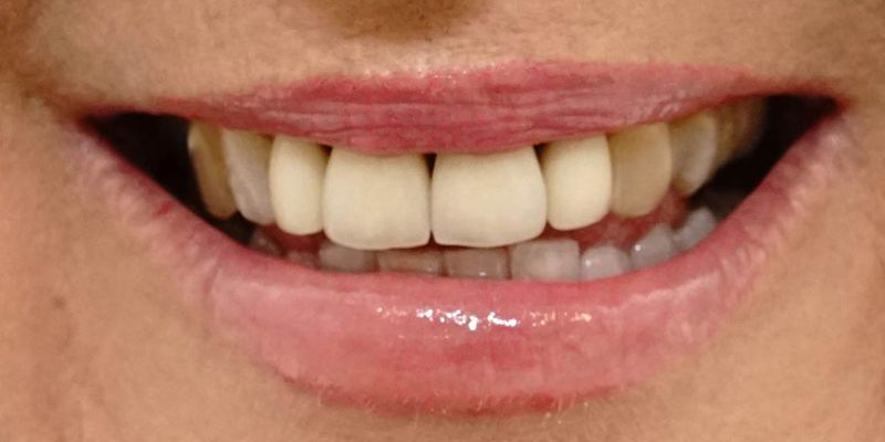 Before_After_Slide_4_Before3