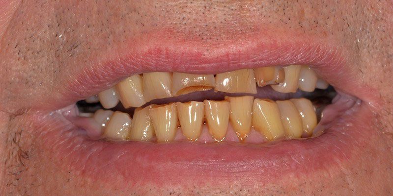 smile-gallery-4-before2